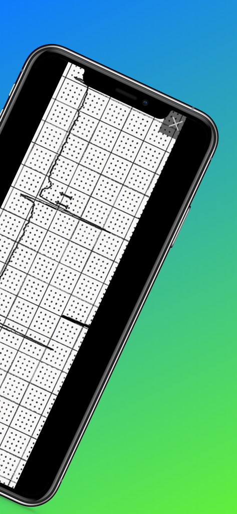 Nahaufnahme eines klinisch erhaltenen EKG-Streifens auf einem Mobiltelefon zum Üben der Interpretation.