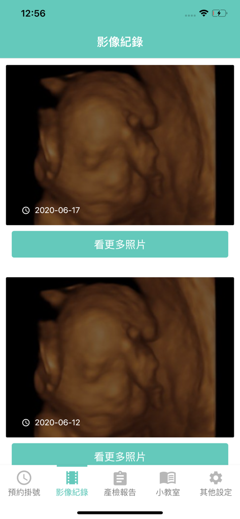 孕安小幫手 - Mobile app interface of Pregnancy Safety Assistant displaying 3D ultrasound images of a fetus with dates and a navigation bar.