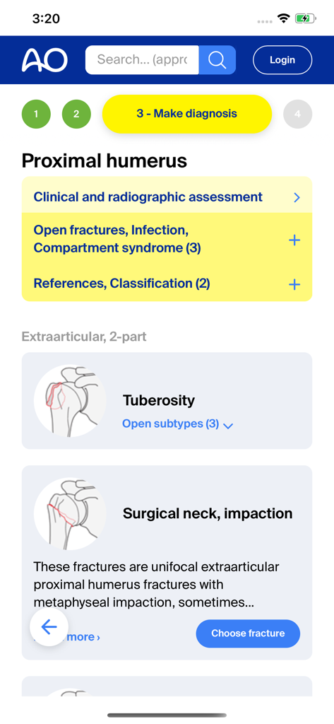 AO Surgery Reference - AO Surgery Reference App zeigt einen diagnostischen Workflow für proximale Humerusfrakturen
