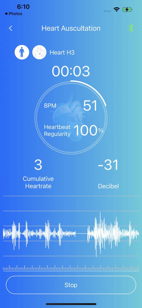 Interfaccia dell'app mobile Skeeper Health Mate che mostra dati di auscultazione cardiaca in tempo reale inclusi BPM e regolarità del battito cardiaco