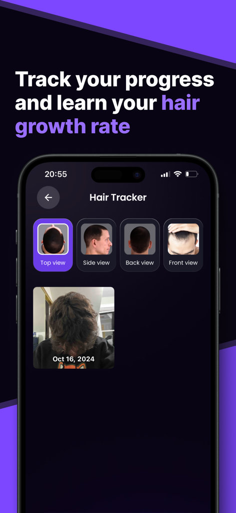 Hair Snap app interface showing the Hair Tracker feature with multiple photo angles to monitor growth rate
