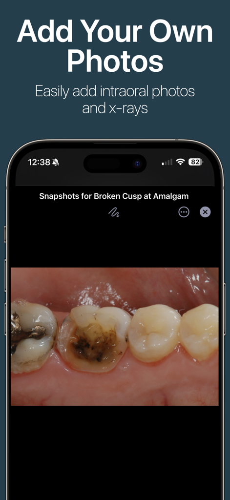 DDS GP app displaying an intraoral dental photo of teeth for patient education