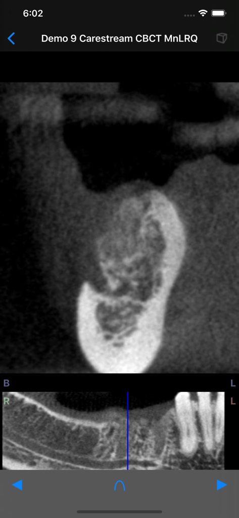Dental CT View - High resolution 3D CBCT scan of a jaw displayed in the Dental CT View app interface
