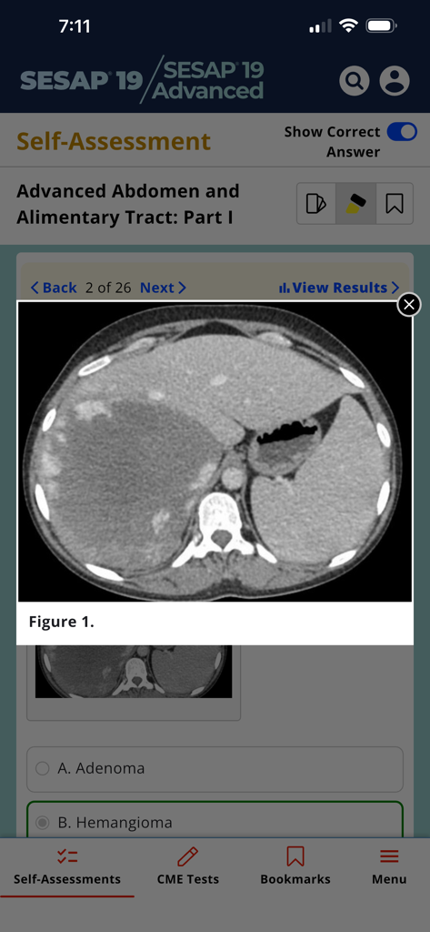 ACS SESAP 19 - Surgical self-assessment module with a radiographic medical image in the ACS SESAP 19 app