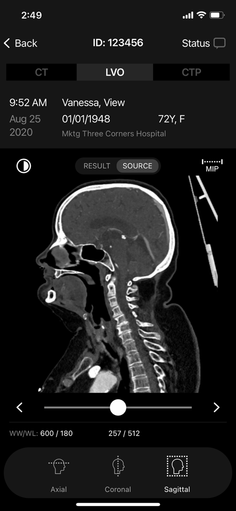 RapidAI mobile DICOM viewer showing a sagittal CT scan of a patient