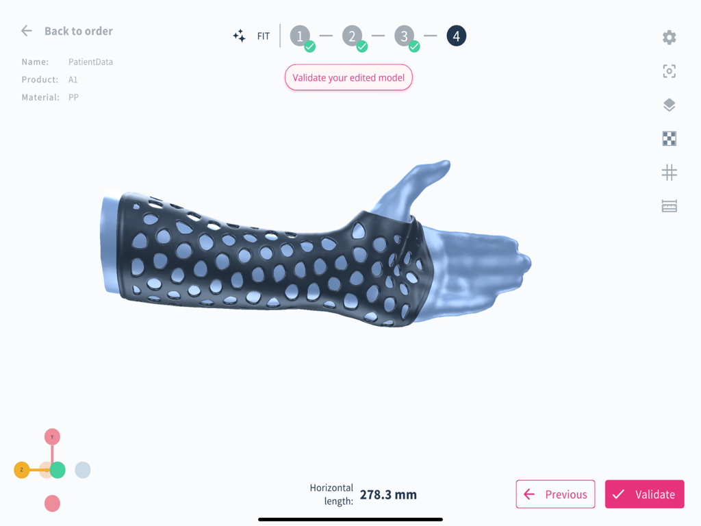 Spentys | The All-in-One 3D Printing Solution for Orthotics