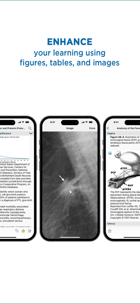 Gynecology and Obstetrics - Medical app screens displaying clinical data charts, imaging, and anatomical illustrations for OB GYN professionals.