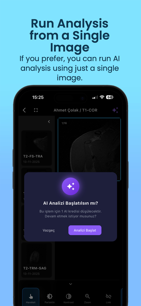 Kayrona DICOM AI Viewer - Mobile interface of Kayrona DICOM AI Viewer showing a prompt to start AI analysis on a single medical image slice