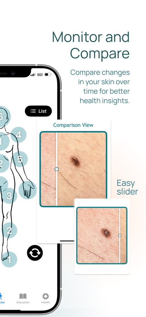 Mobile app interface showing a side by side comparison of a skin mole with a slider for tracking changes