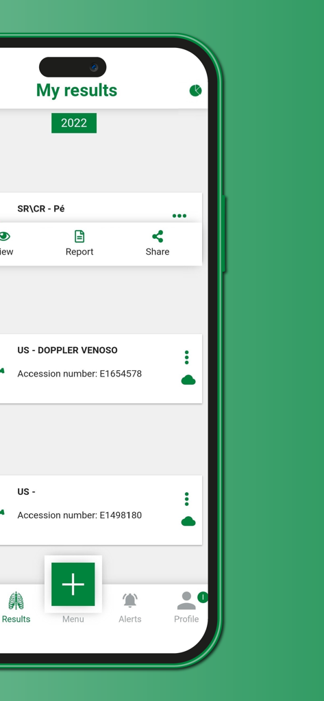 Cruz Verde - Mobile interface of the Cruz Verde app displaying clinical exam results.