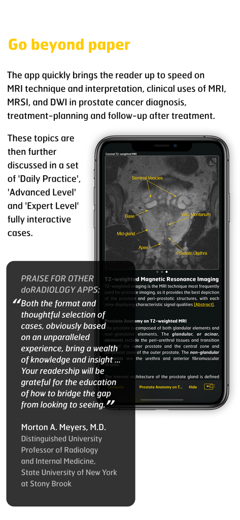 MR Imaging in Prostate Cancer - Screenshot of the MR Imaging in Prostate Cancer app showing anatomical labels on a prostate scan and a clinical testimonial
