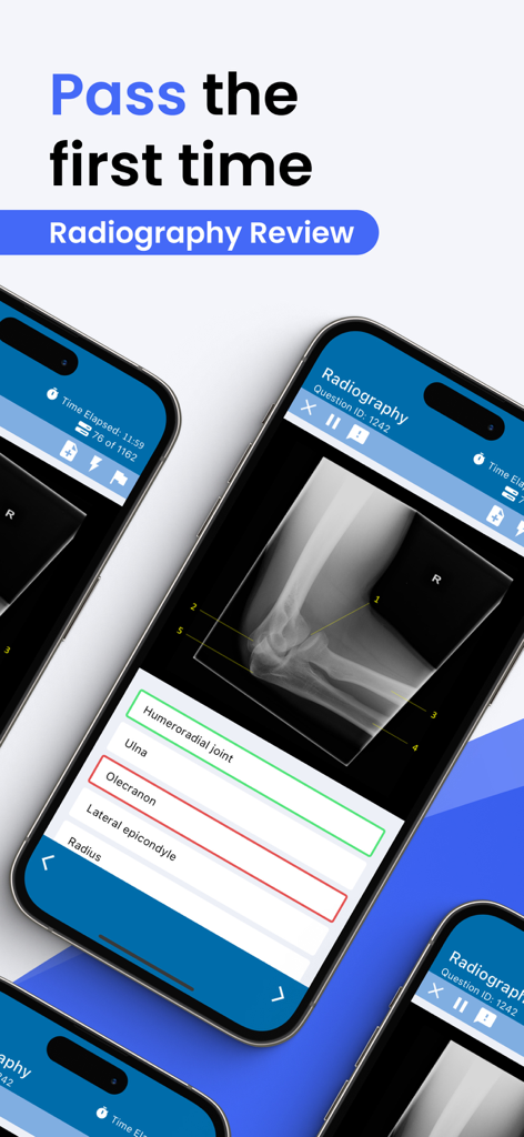 Prepry - Radiography Exam Prep - Radiography exam prep mobile app showing a practice quiz with medical X-ray imaging