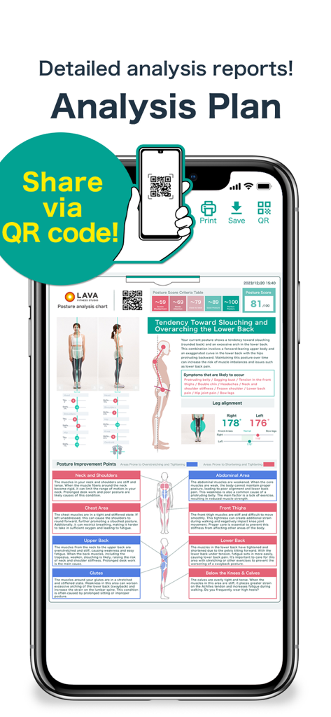 AI posture/BODY Alignment - Relatório detalhado de análise de postura por IA com opção de compartilhamento de código QR para profissionais de fitness.