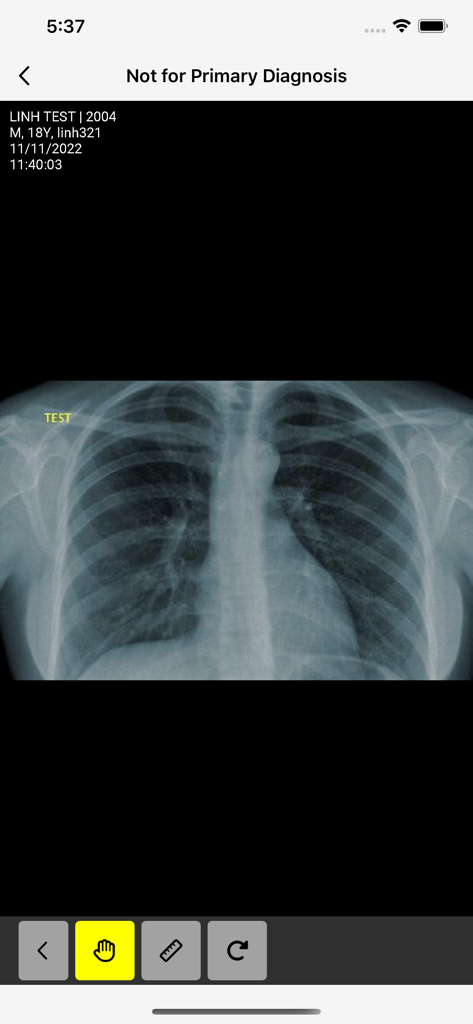 Chest X-ray viewing interface in the PMR PACS mobile app