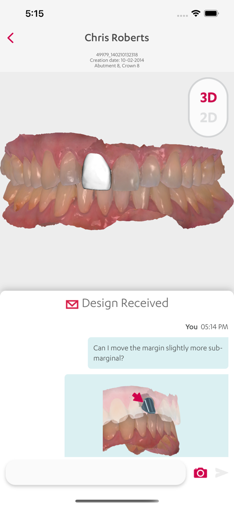 Mobile interface showing a 3D dental scan and a chat window for design feedback