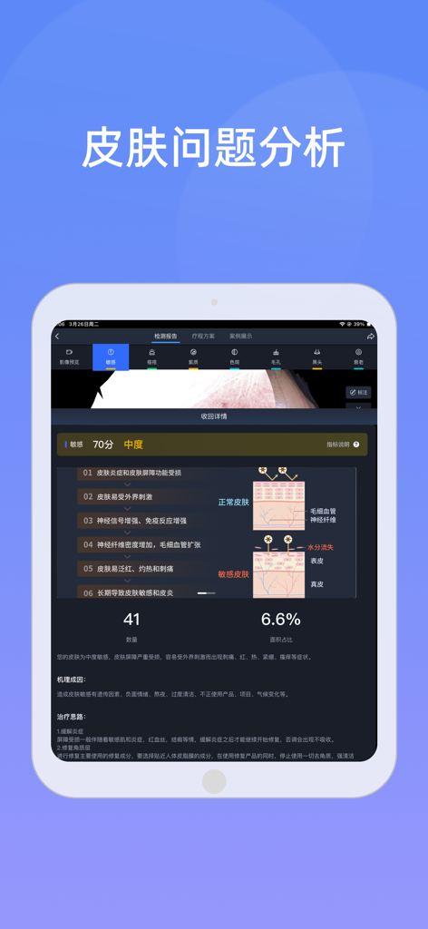 优颜3D - 민감도 진단 및 해부학적 피부 다이어그램이 포함된 전문 피부 분석 보고서를 표시하는 태블릿