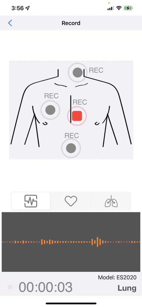 Smart Stethoscope - Smart Stethoscope app interface showing a torso map for recording points and a real-time lung sound audio waveform