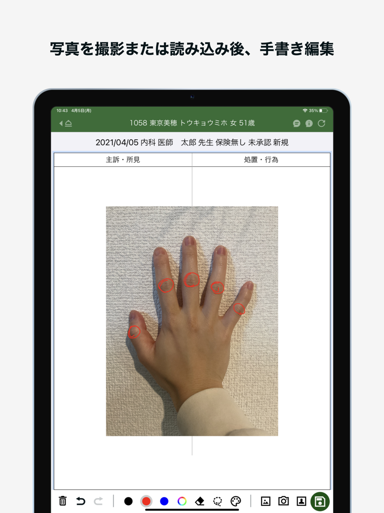M3 DigiKar - Medical app on iPad showing a photo of a hand with red circular annotations on the finger joints