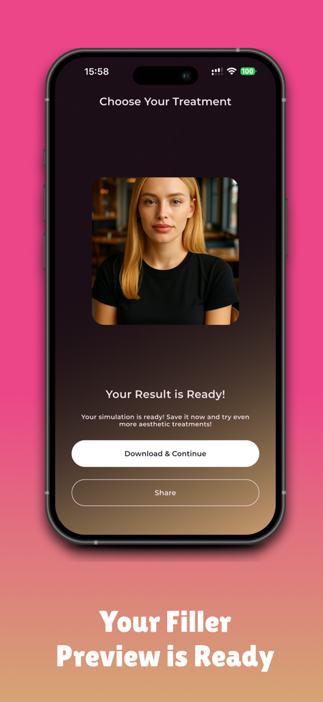 스마트폰 화면에 표시되는 AI 생성 얼굴 필러 시뮬레이션 미리보기