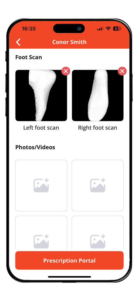 FUSION Plus - The FUSION Plus app interface displaying 3D anatomical foot scans for a patient profile