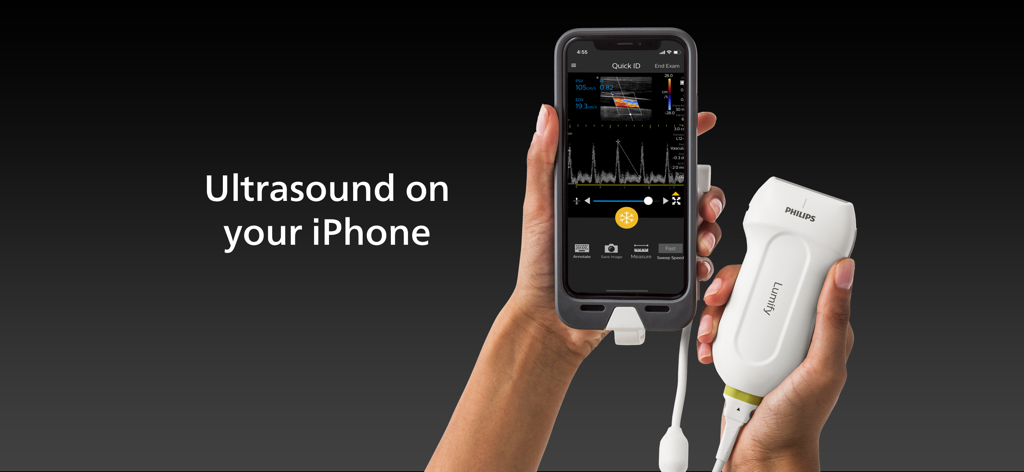 A person holding a Philips Lumify transducer and an iPhone displaying a live ultrasound scan