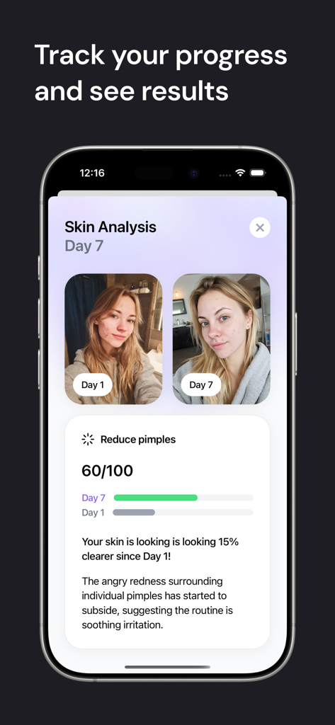 Halo-App-Oberfläche, die einen Seitenvergleich der Hautanalyse zwischen Tag 1 und Tag 7 mit Ergebnissen zur Fortschrittsverfolgung zeigt.