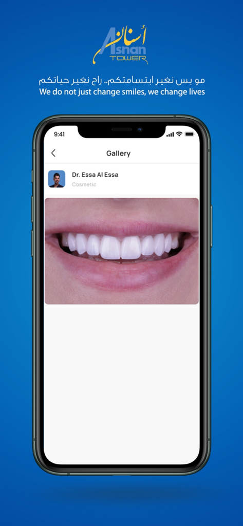 Asnan Tower - Asnan Tower app gallery showing a cosmetic dental smile transformation