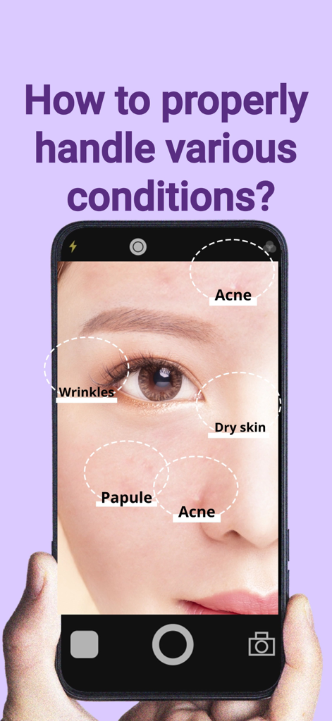 Skin AI - Best AI Skin Expert - La pantalla de un smartphone que muestra un análisis de IA de condiciones de la piel como acné y arrugas