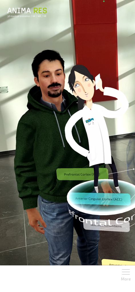 EpiBrain拡張現実ビューには、脳領域のホログラムと、人物の上に重ねられた仮想医師が表示されます。