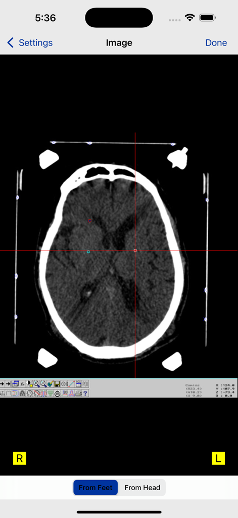 StereoCheck - Axial brain CT scan with fiducial markers and coordinate crosshairs in the StereoCheck app interface.