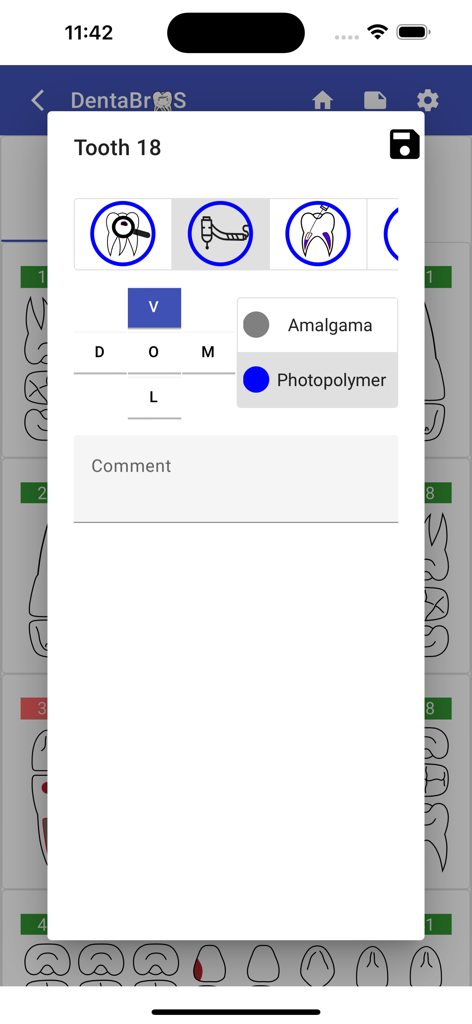 Dentabros - Dental Software - 특정 치아에 대한 치료 옵션 및 충치 종류를 보여주는 DentaBros 앱의 치과 차팅 인터페이스