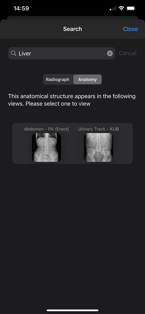 Xray Anatomy app search interface showing radiographic results for the liver anatomical structure