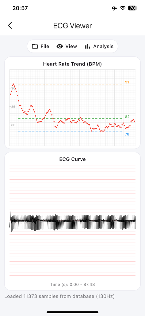 ECG Suite - Health & Fitness App | MWM