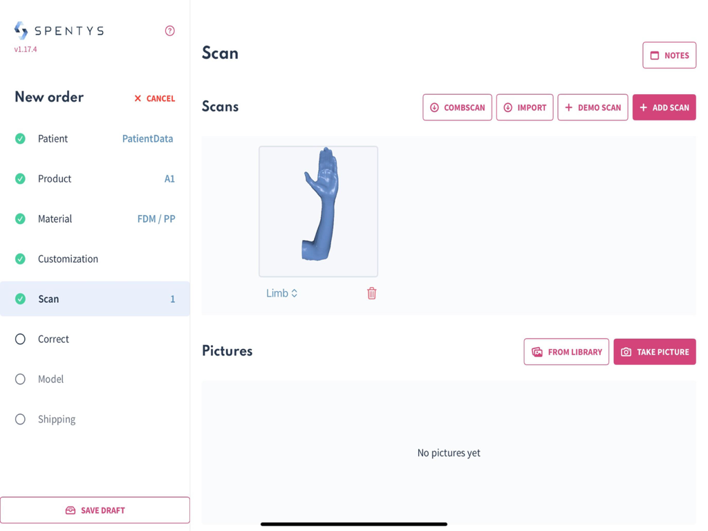 Spentys | The All-in-One 3D Printing Solution for Orthotics