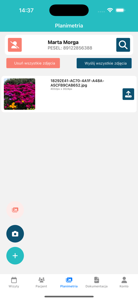 ESOZ - The ESOZ medical app screen for patient planimetry showing clinical photo records and medical management options