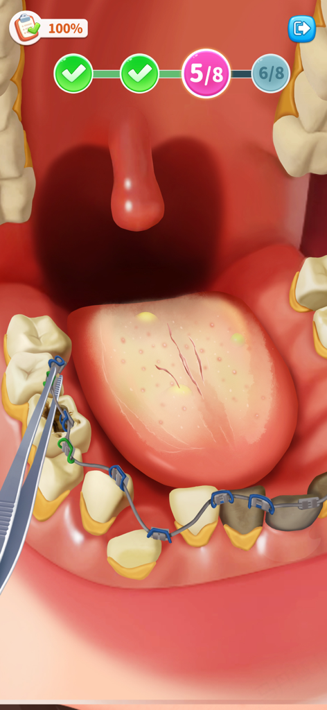 Match Villa™: Makeup ASMR - Jogabilidade de tratamento dental ASMR mostrando limpeza de aparelhos e cuidados com a língua em Match Villa.