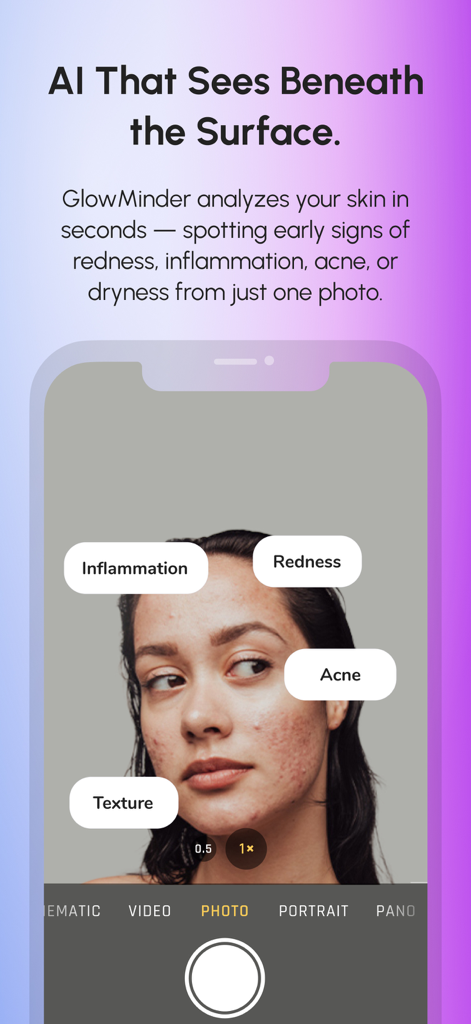 Glow Minder: Improved Skin - Interfaz de la aplicación Glow Minder que muestra un escaneo facial con IA detectando problemas de la piel como acné, rojeces e inflamación en el rostro de un usuario