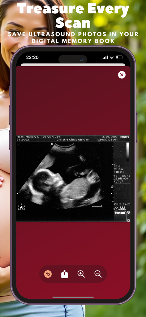 My Baby - Pregnancy Diary - Una pantalla de teléfono móvil que muestra una foto de ecografía dentro de la aplicación Mi Bebé - Diario de Embarazo