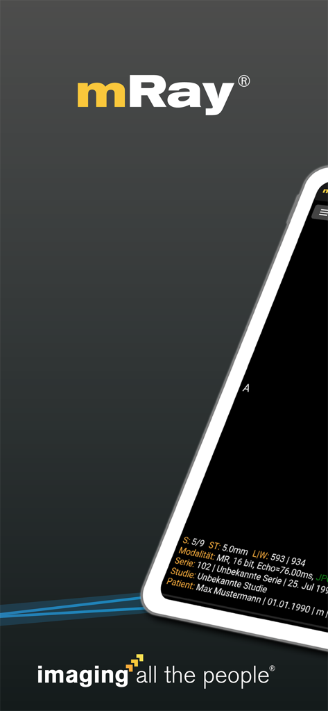 Interface de l'application mobile mRay affichant des données d'imagerie radiologique sur un appareil tablette