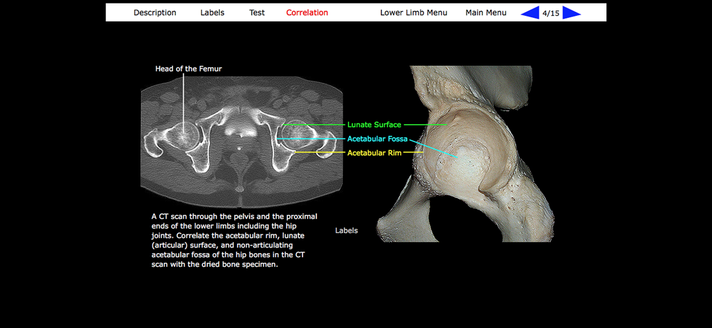 Correlazione affiancata di una TAC del bacino e di un vero campione osseo umano con etichette anatomiche