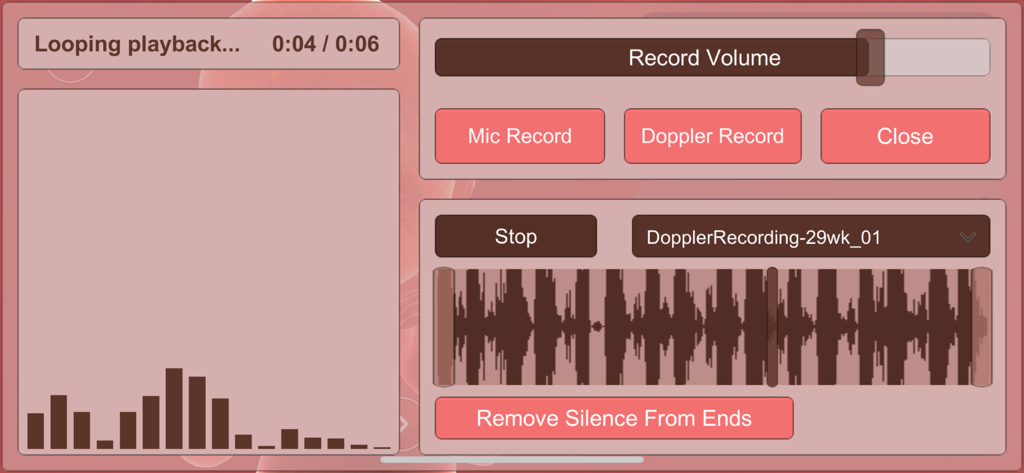 Aluvuu Fetus - Interface for recording and playing back fetal heart sounds in the Aluvuu Fetus app showing audio waveforms