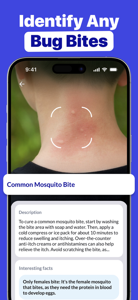 Smartphone screen of the AI Scanner app identifying a common mosquito bite on a person's neck with treatment instructions