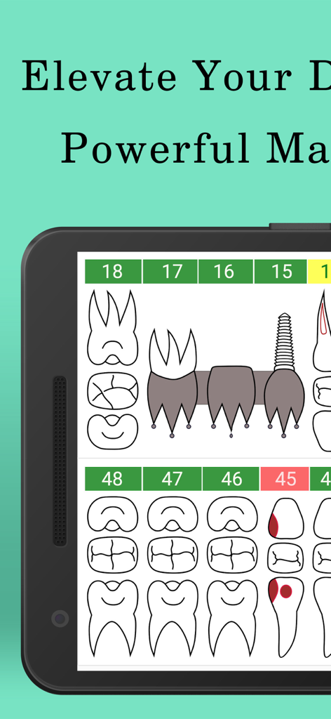 Dentabros - Dental Software - 진료 관리용 모바일 기기의 디지털 치과 차트 인터페이스
