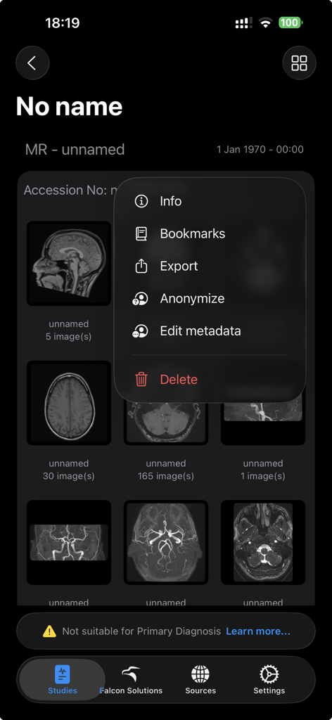 Falcon Mx - Interface of Falcon Mx showing MRI scans and a menu for exporting and anonymizing medical studies