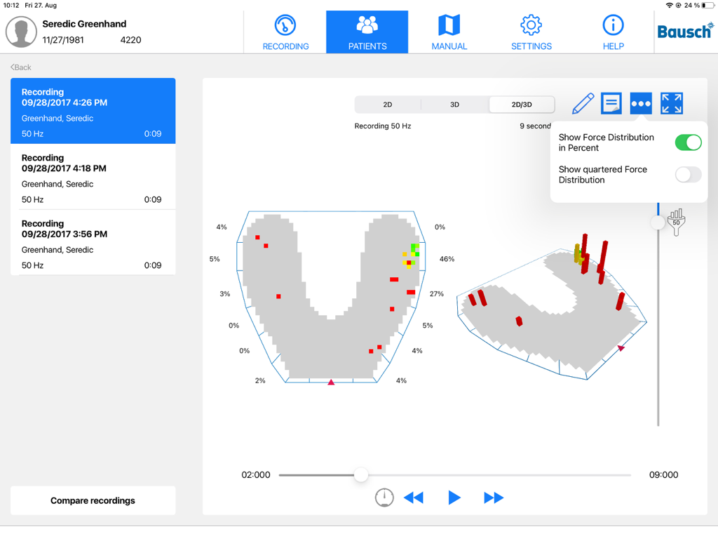 OccluSense - Dental occlusion pressure analysis with 2D and 3D maps in the OccluSense app