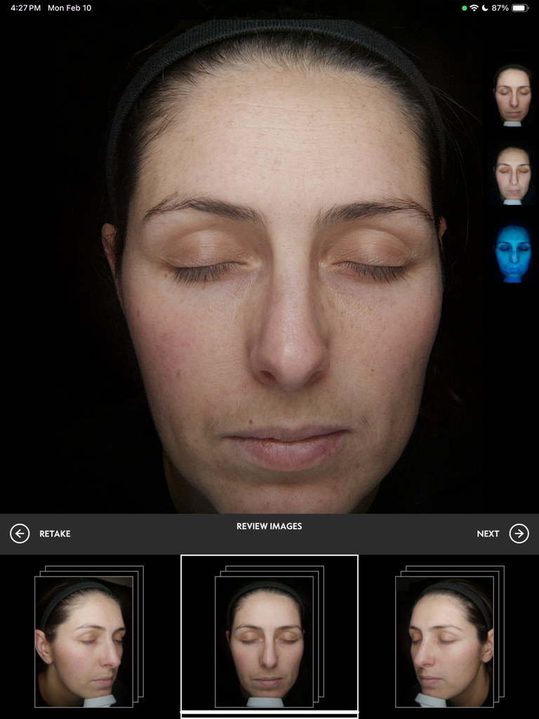 NEXA app interface displaying facial images for professional skin analysis review