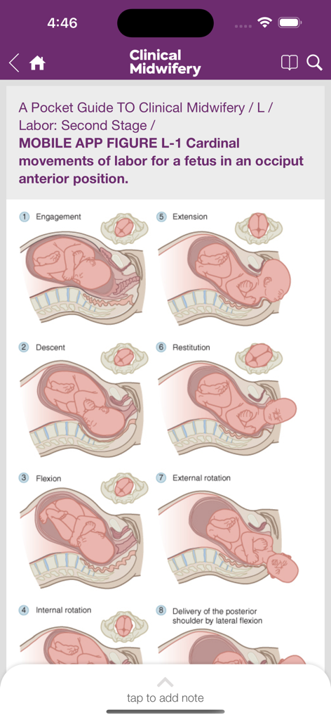 Guide to Clinical Midwifery - Diagram showing the eight cardinal movements of labor for a fetus in an occiput anterior position.