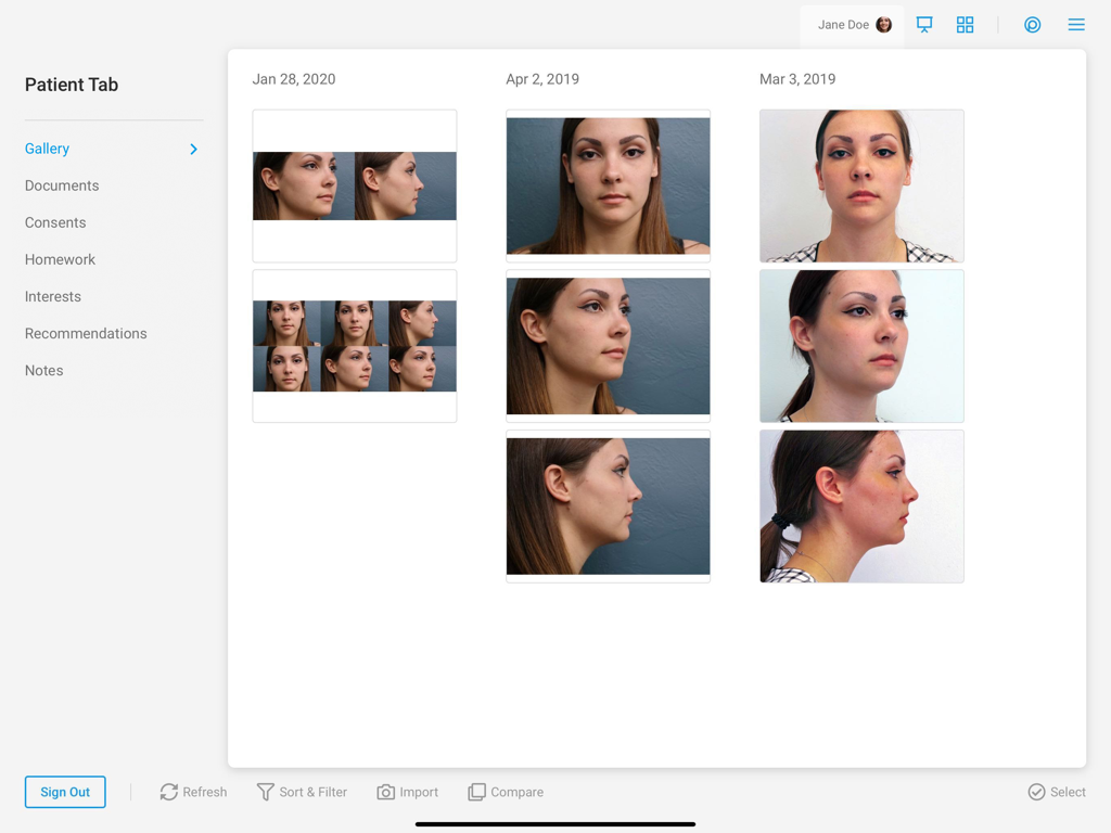 TouchMD Consult - for Staff - A patient photo gallery within the TouchMD Consult app showing facial clinical photos organized by date for medical consultation.