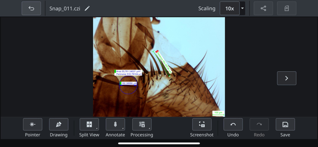 Labscope app interface showing a microscopic specimen with area and distance measurements
