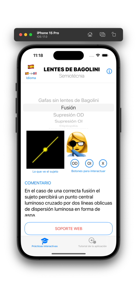 Bagolini Test - Mobile interface of the Bagolini Test app showing a visual simulation and clinical commentary for ophthalmology practice.
